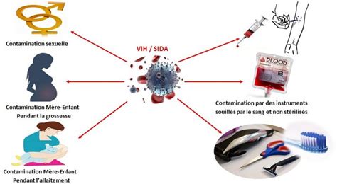 La transmission du VIH par rapports oraux